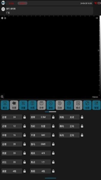 汉德超声下载 v1.1.4 1