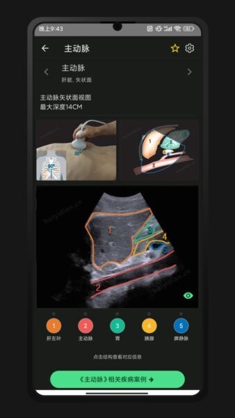 超声智学下载 v2.0.0 0