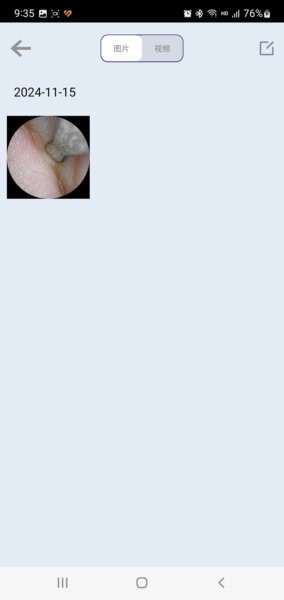 SLVisual无线可视挖耳勺下载 v1.5 1